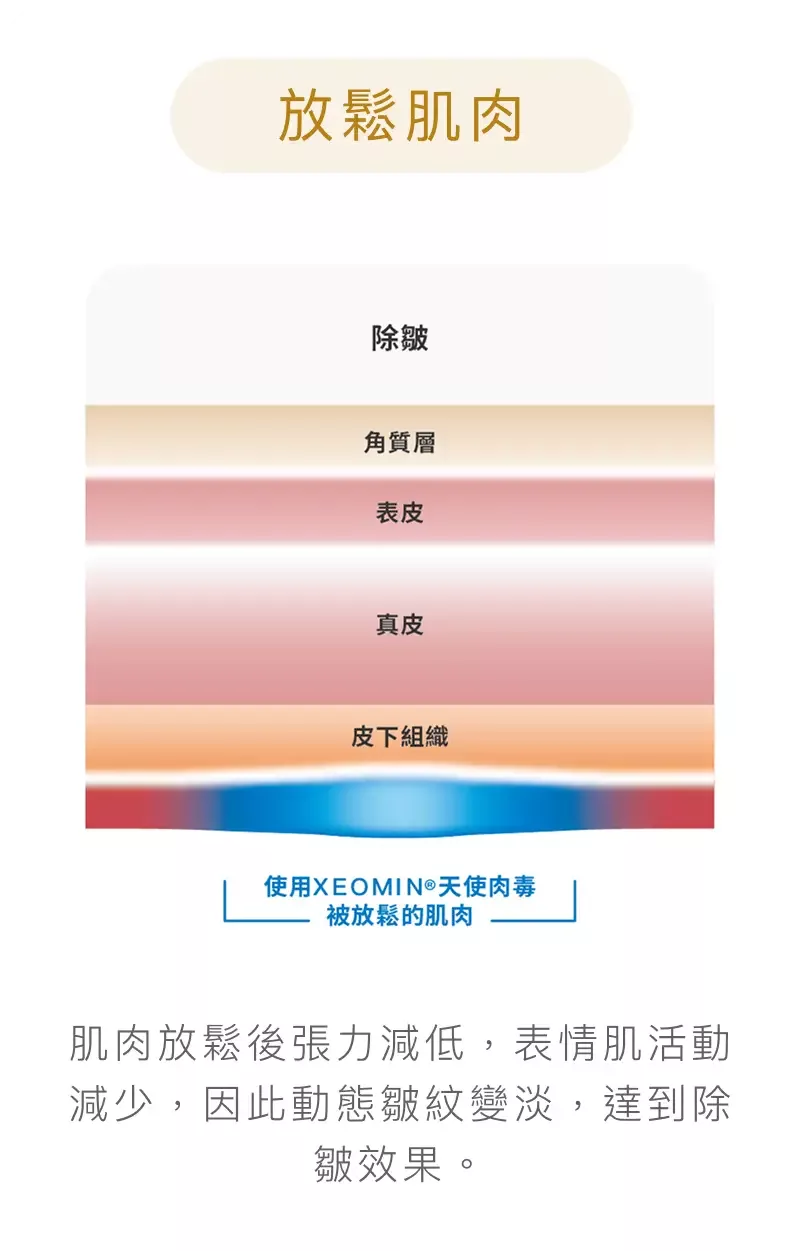淨優明天使肉毒 XEOMIN 4 淨優明天使肉毒 XEOMIN作用原理圖