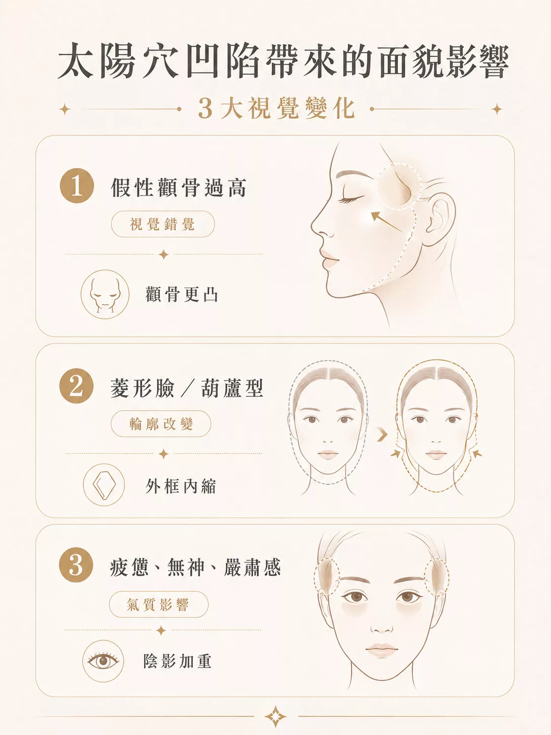 太陽穴凹陷怎麼辦?夫妻宮填補與醫美療程選擇指南 3 太陽穴凹陷的面貌影響與改善
