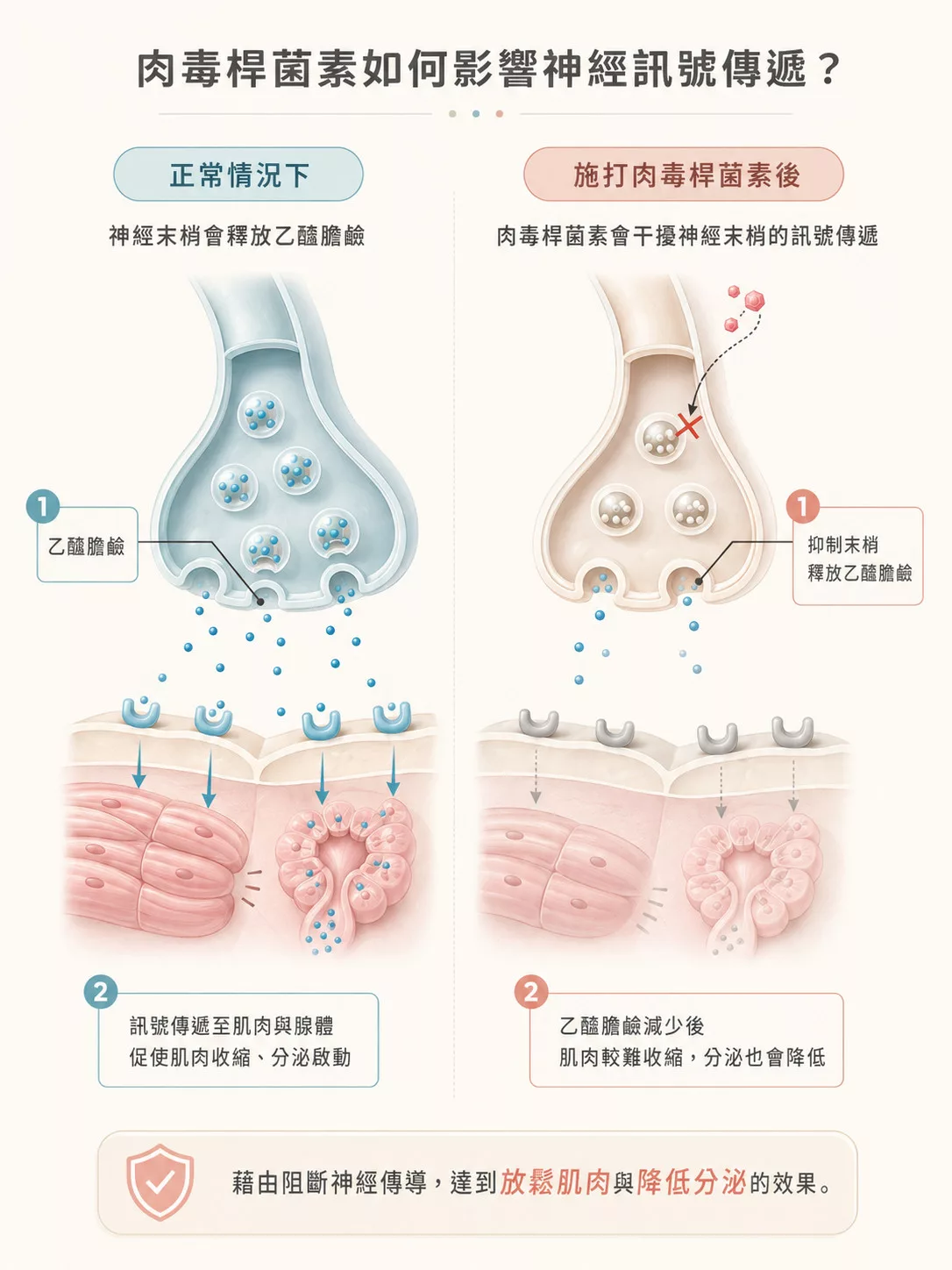 肉毒除皺全攻略》效果多久出現?6大肉毒品牌價格、劑量與不僵硬關鍵拆解 1 肉毒桿菌如何影響神經傳遞,導致肌肉放鬆