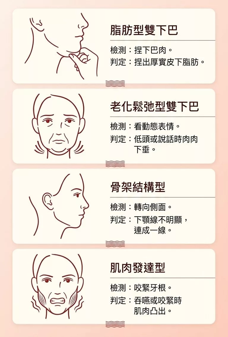 雙下巴醫美怎麼選?5大成因、熱門療程費用總整理 1 雙下巴成因圖解:脂肪型、老化鬆弛、骨架、肌肉